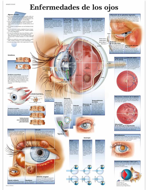 Lamina enfermedades de los ojos - Alta calidad, formato 50x67cm